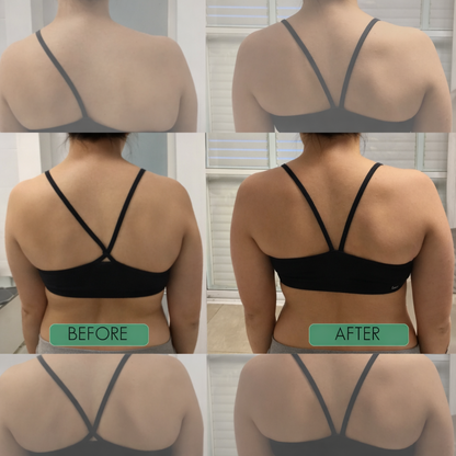 Instant Posture Corrector