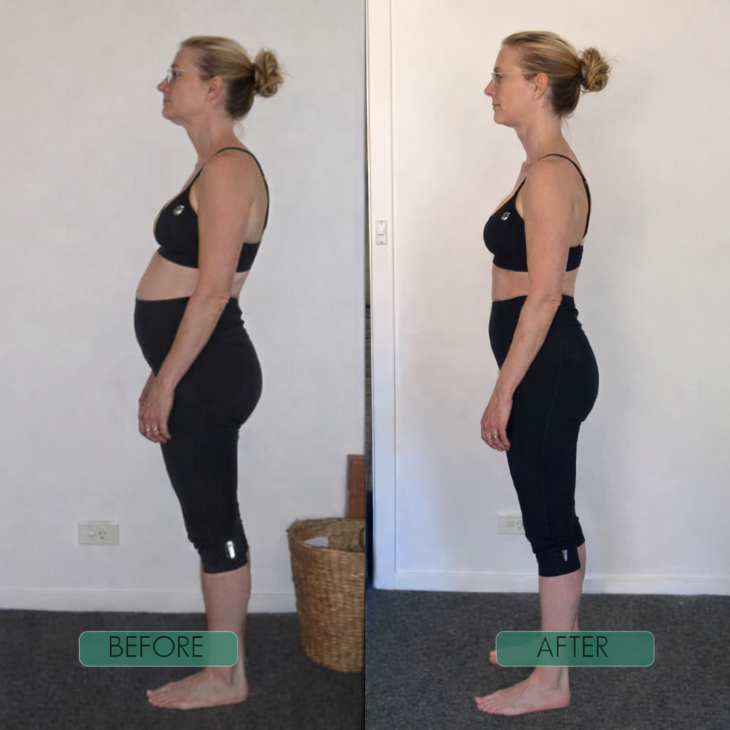 Instant Posture Corrector